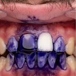 PURPLE V34 - Blanqueador Dental